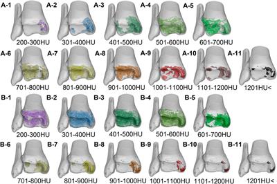 Characterization of Changes in Subchondral Bone Tissue Density of the Ankle Joint in Taekwondo Players